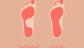 Tout ou partie de cette définition est extrait du dictionnaire de l'académie le dictionnaire des synonymes permet de trouver des termes plus adaptés au contexte ou des termes plus précis que ceux utilisé habituellement. Quelles Chaussures Porter Quand On A Les Pieds Plats