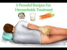 10 Hemorrhoid Ideas Hemorrhoids Hemorrhoids Treatment Hemorrhoid Remedies