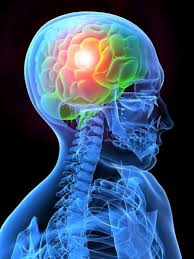 Neural Plasticity: 4 Steps to Change Your Brain & Habits