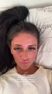 Covering Grey Hairs: Tips for Young Adults