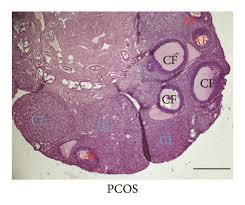 Image result for Phyllanthus muellerianus