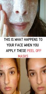 You will probably feel a tingling sensation but don't worry its normal and it will. Blackhead Clearing Mask Diy 2021 Easy Diy Ideas