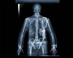 X-ray Striking Pregnant Women And Body Art - Pix Magazine X Ray Xray Art Love Movie