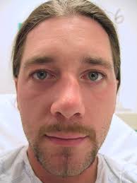 Check spelling or type a new query. Nose Procedures Simoni Plastic Surgery