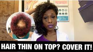 This is one of the haircuts for balding black men having short hair and matches all types of shapes of the face. Natural Hairstyles For Thinning Crown Youtube