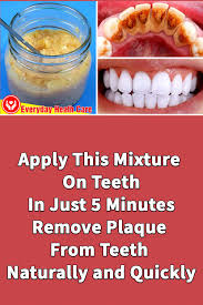 Move your toothbrush back and forth in short, gentle strokes the same width as each. How To Remove Plaque From Teeth At Home Naturally Arxiusarquitectura