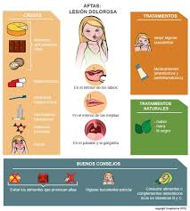La mayoría de las aftas son redondas u ovaladas y tienen un centro blanco o amarillo y un borde rojo. Aftas Causas Sintomas Tratamientos Creasalud Com