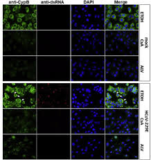 Sandra ciesek, die leiterin der virologie des universitätsklinikums frankfurt am main. Influences Of Cyclosporin A And Non Immunosuppressive Derivatives On Cellular Cyclophilins And Viral Nucleocapsid Protein During Human Coronavirus 229e Replication Sciencedirect