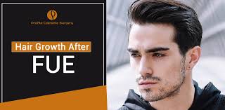 The second session consisted of 1,509 follicular unit grafts. Everything You Need To Know About Hair Growth After Fue Hair Transplant Blog Profile Studios