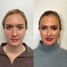 Brooke Carrero RN, BSN