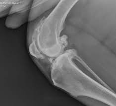 Bone cancer usually affects only one bone and causes a fracture, for pain. Canine Total Knee Replacement Fitzpatrick Referrals