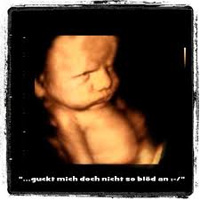 Das baby ist dann schon so weit entwickelt, dass sich die details schön erkennen lassen. 3d 4d Ultraschall Bei Www Babyfacing De Ultraschall 4d Ultraschall Kinder
