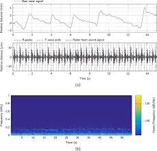 The list of bb codes you can use to spice up the look of your messages. A Dataset Of Radar Recorded Heart Sounds And Vital Signs Including Synchronised Reference Sensor Signals Scientific Data