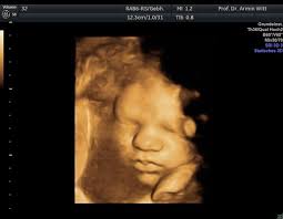 Jedoch geht es hierbei um den körper und seine inneren organe. Gesundheit Der Frau Ultraschall 3d 4d Doppler