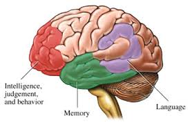 「alzheimer's disease」的圖片搜尋結果