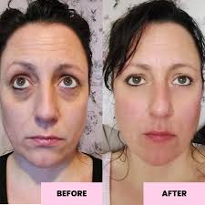 100% Evidence Based Skincare