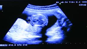 Baby Boy Ultrasound Of 20st Arkivvideomateriale 100 Royaltyfritt 26445797 Shutterstock