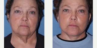 T. Gerald O`Daniel, MD, Board Certified Plastic Surgeon