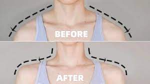 Eng) Perfect Posture Challenge! | Fix Rounded Shoulders & Hunchback Posture  In 2 Weeks - Youtube
