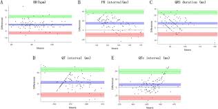 Image result for Electrocardiogram Validity