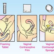 Image result for Contraceptive Sponge