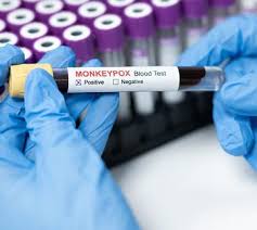 Observer Research Foundation: India's bioE3 policy for #mpox