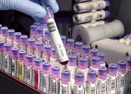 Polymerase chain reaction (pcr) is a method widely used to rapidly make millions to billions of copies (complete copies or partial copies) of a specific dna sample, allowing scientists to take a very small sample of dna and amplify it (or a part of it) to a large enough amount to study in detail. Pcr Diagnostika Opisanie Metodiki Fotografii Stoimost