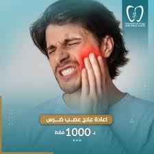 ابتسامة الدايركت فينير عرض الشخصين 16 سن