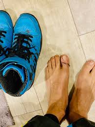 If you have a broken toe, you need to seek medical attention to avoid complications such as deformity, bone spurs, or hammer toe. Ken Block My Broken Big Toe Worked For Racing I Was Very ÙÙŠØ³Ø¨ÙˆÙƒ