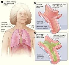 Pin On Health