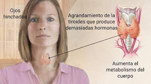 Pin En Consejos De Salud