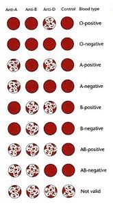 74 Punctilious Blood Group Flow Chart