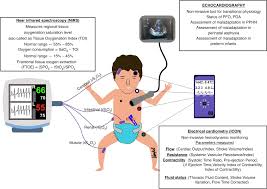 Image result for Delayed Transition from Fetal Circulation