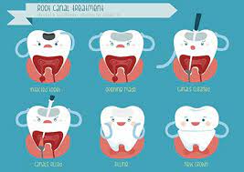 A root canaled tooth needs the protection of a crown. Can A Root Canal Be Done Through An Existing Crown Plage Dentistry