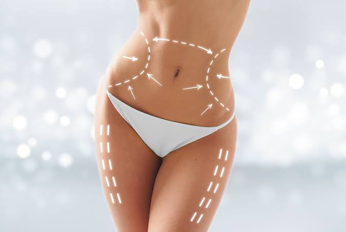Liposuccion &agrave; Paris (lipoaspiration) | Dr HADDAD