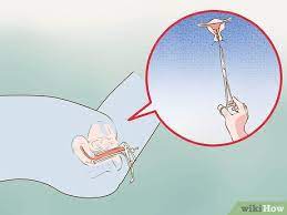 Mich würden eure erfahrungen diesbezüglich interessieren! Eine Spirale Entfernen Lassen 9 Schritte Mit Bildern Wikihow
