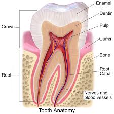 Image result for Tooth Fracture