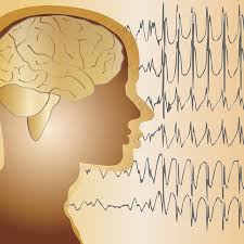 Epilepsy is a disorder of the brain characterized by repeated seizures. Epilepsy Late In Life