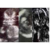Gambar proses perkembangan pertumbuhan bayi janin dalam kandungan dan hasil usg 4d usia 14 minggu (3 bulan lebih) tulang dan sumsum tulang di dalam sistem kerangka terus berkembang. Gambar Gambar Aneh Dalam Foto Usg