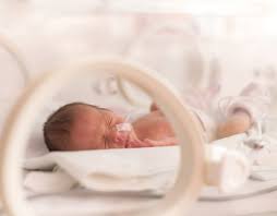 Image result for Preterm Infant