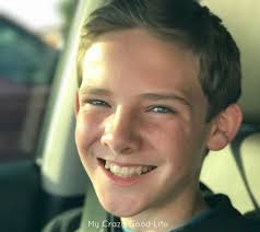 Is Invisalign For Teens? : My Crazy Good Life