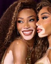 Kylie Kelce Reveals Which NFL Team She's Rooting for