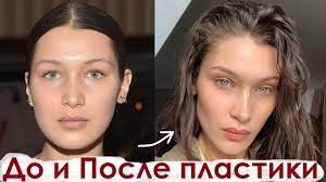 Белла — младшая сестра модели джиджи хадид. Bella Hadid Do I Posle Plastiki 2021 Youtube