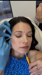 💁🏻‍♀️💉 Smoothed out the drama, kept the sass