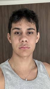 1 MÊS DE CIRURGIA 🎂🤍 Um mês de um sonho realizado, de uma nova etapa na  minha vida. Ainda não tô me reconhecendo kkkk parece que a ficha ainda não  caiu, mas é normal. Aos poucos tudo vai se alinhando. ...