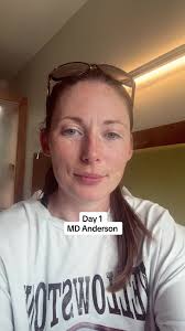 Md Anderson Sonography Program