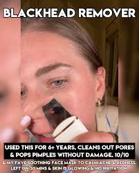 My current faves 😍🫶🏼 things that are just 👏🏼 so 👏🏼 good!!!!! A few  of these are brand new but so many of these are my tried & true from over  the years. ⭐️ that blackhead remover/pimple popper thoooo! ...