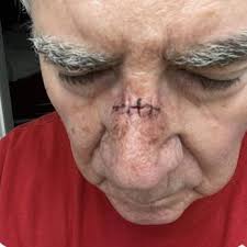 MILLIGAN DERMATOLOGY