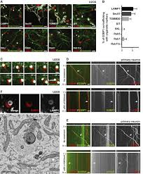 I think people get too connected to their phones, they send lots of messages. Rna Granules Hitchhike On Lysosomes For Long Distance Transport Using Annexin A11 As A Molecular Tether Sciencedirect