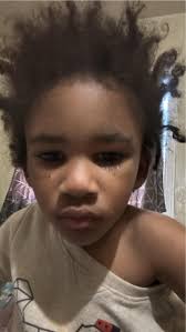 Traumatic flashbacks after closed foster care case